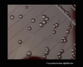 corynebacterium diphtheriae